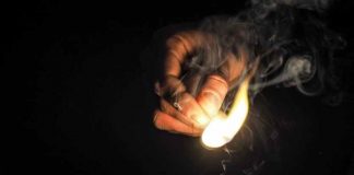 Home Remedies For Burns Burns